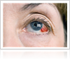 Ways to Prevent Eye Injuries